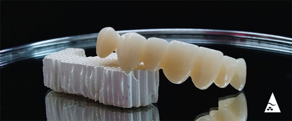 Cementación de restauraciones dentales basadas en zirconio una